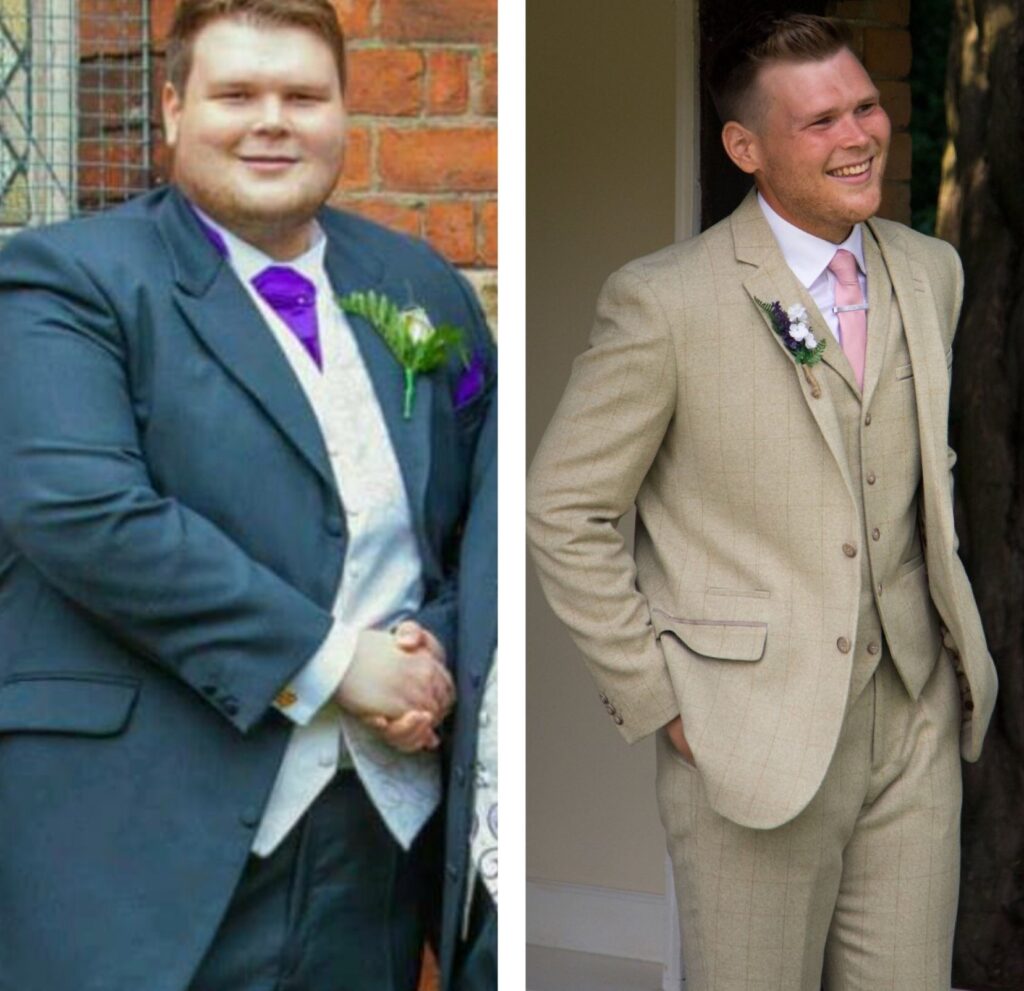 A before and after photo of a man who has lost a lot of weight.
